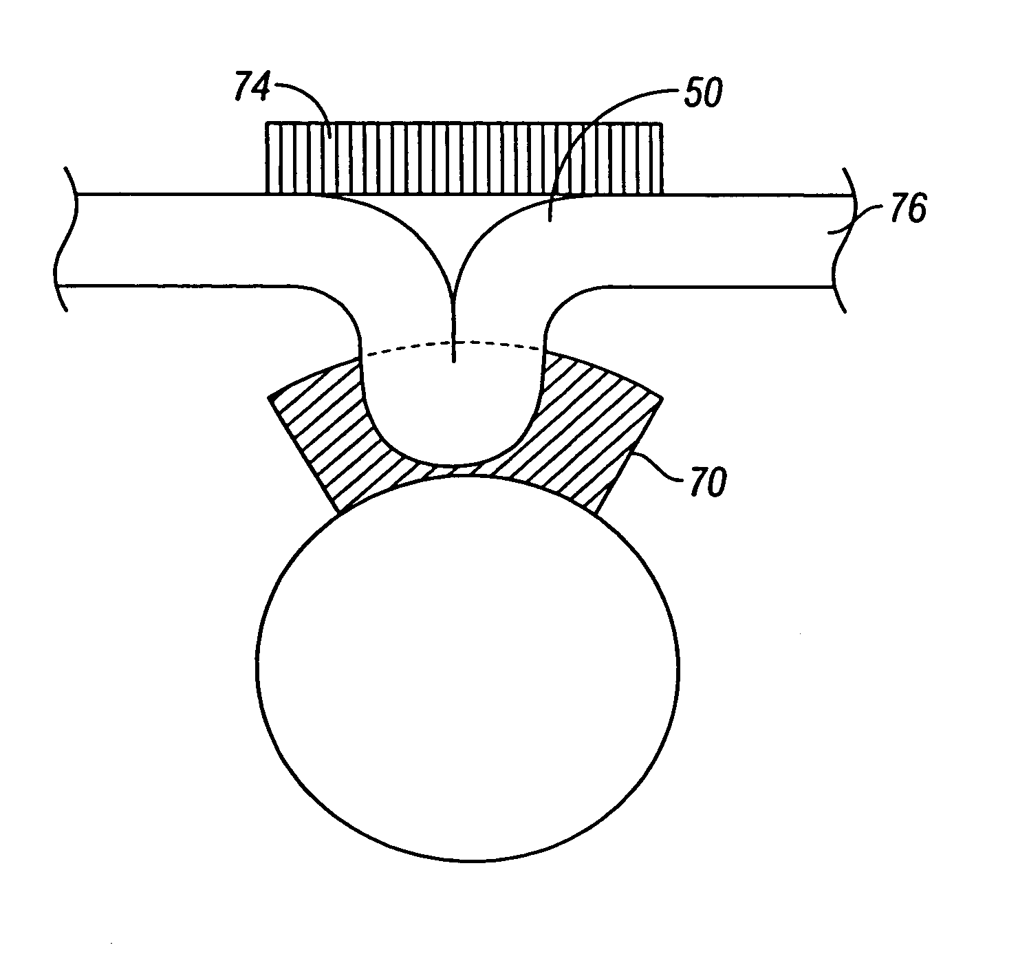 Magnetic anchoring devices