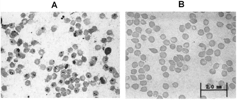 Preparation of artesunate fat emulsion for injection and application of artesunate fat emulsion in treatment of malaria