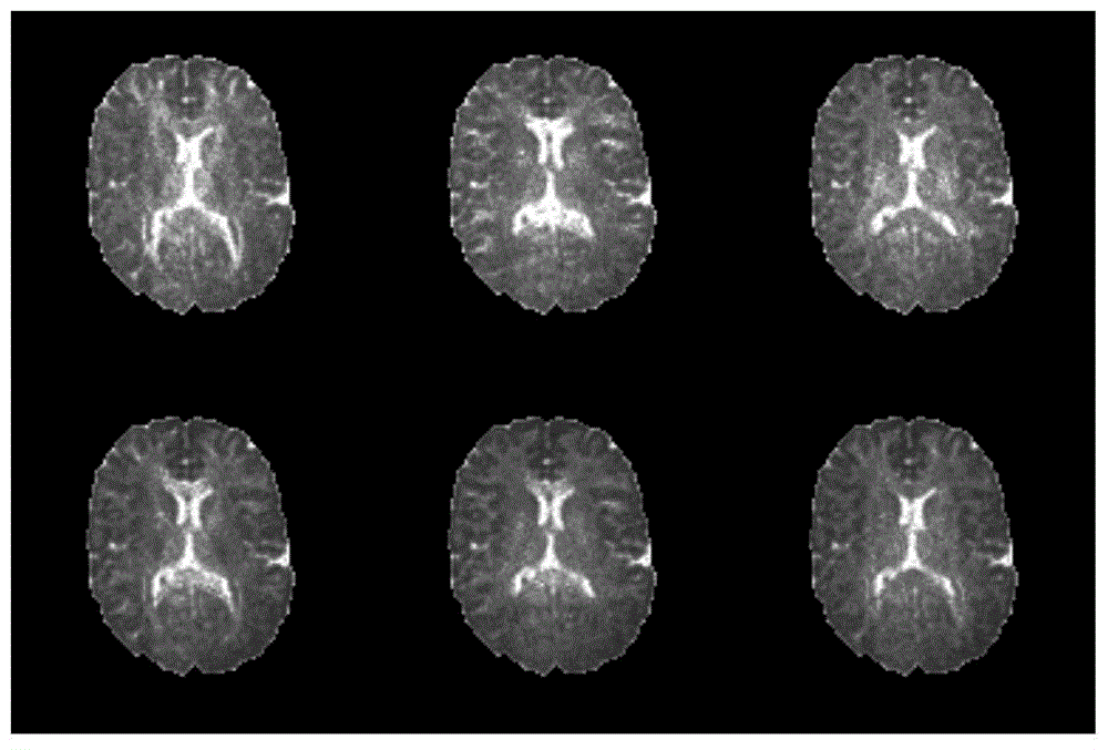 Parameter error estimation method and device for magnetic resonance diffusion tensor imaging