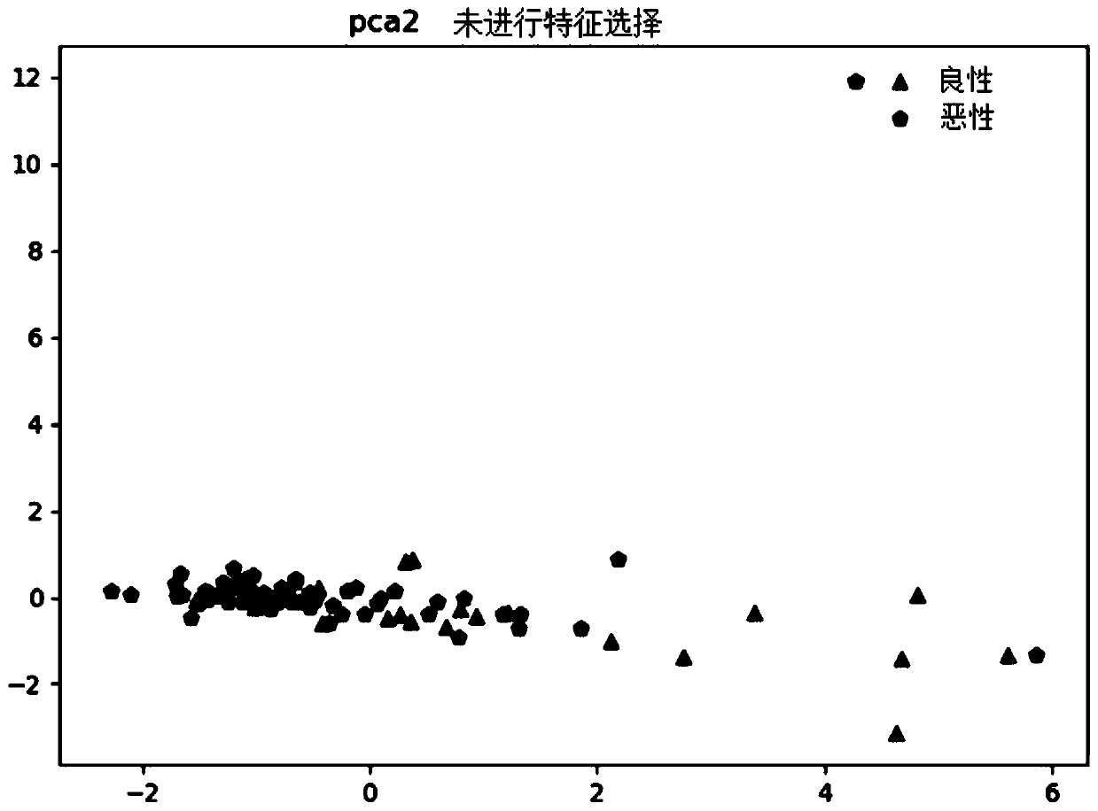 Construction method and device of benign and malignant tumor identification model