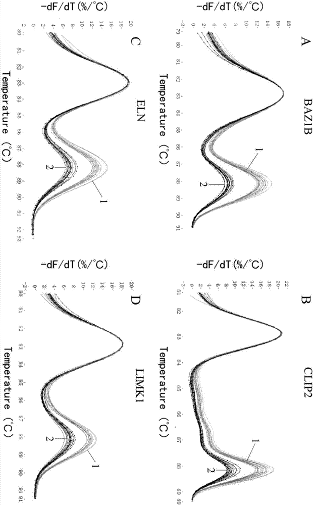 Method for detecting deficiency of 7q11.23