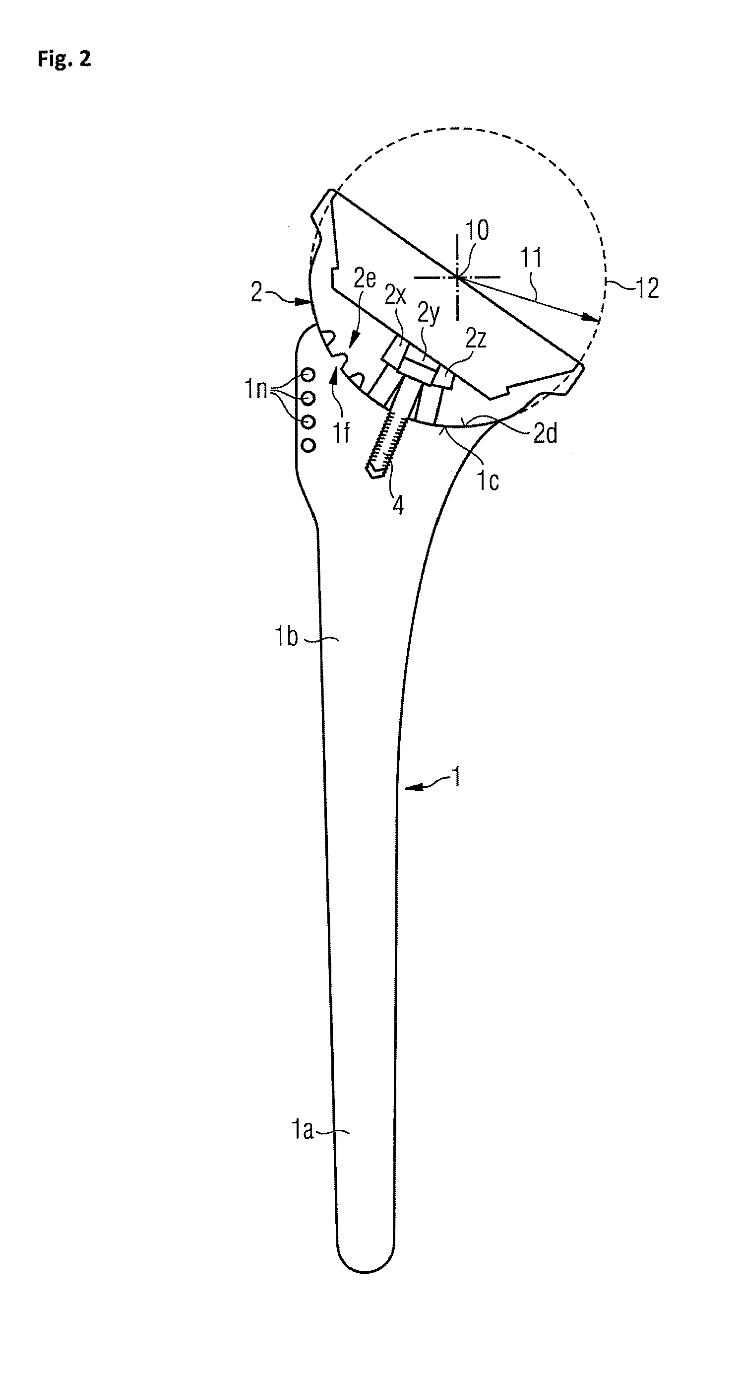 Humeral component of a shoulder prosthesis and methods of shoulder arthroplasty