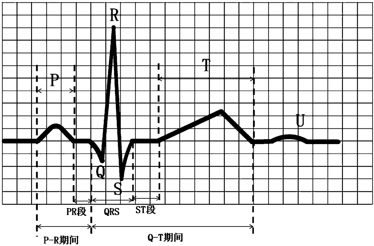 Method and device for identifying electrocardiogram image feature points