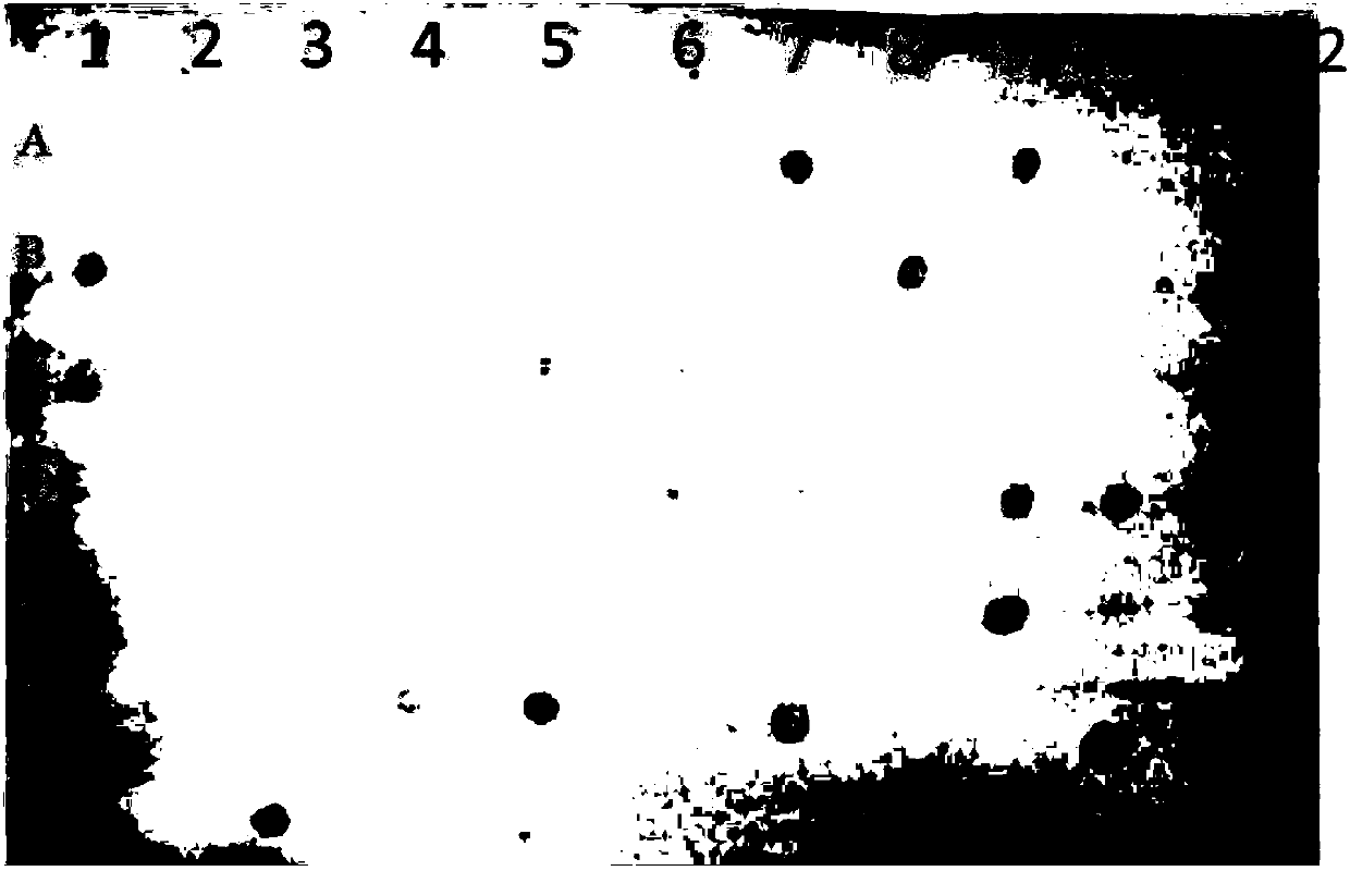 A gene sequence of a human-derived keratinocyte growth factor-2, an expression vector and a production method