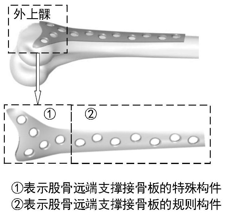 Design method of assembled adjustable personalized bone fracture plate