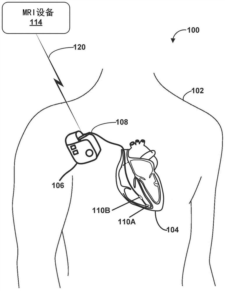 Selection of test vectors for MRI security testing for implantable medical device design