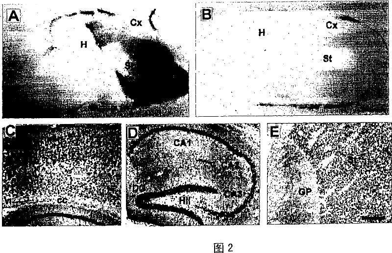 Model for neurodegenerative disease