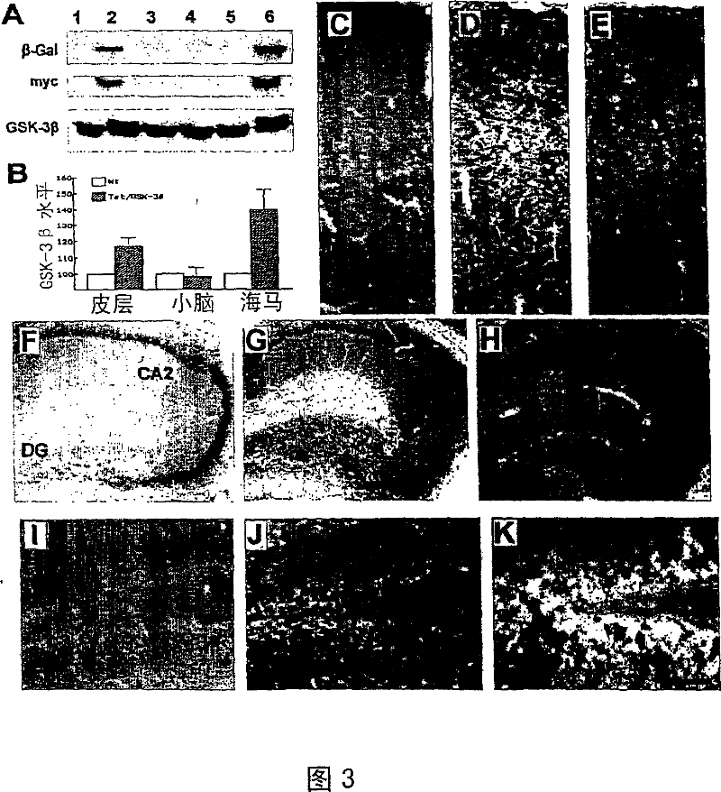 Model for neurodegenerative disease