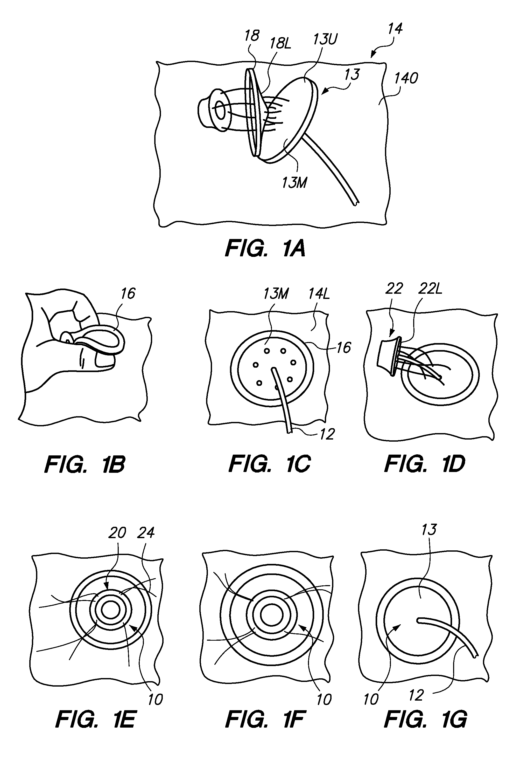 Port System and Methods