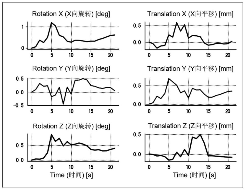 Brain perfusion image processing method, system and device and storage medium