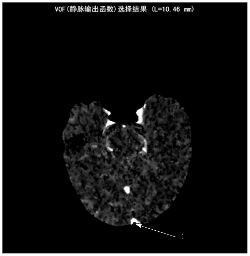 Brain perfusion image processing method, system and device and storage medium