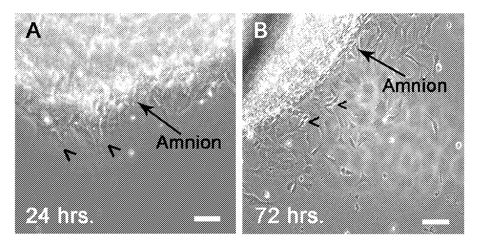 Amnion-derived stem cells and uses thereof