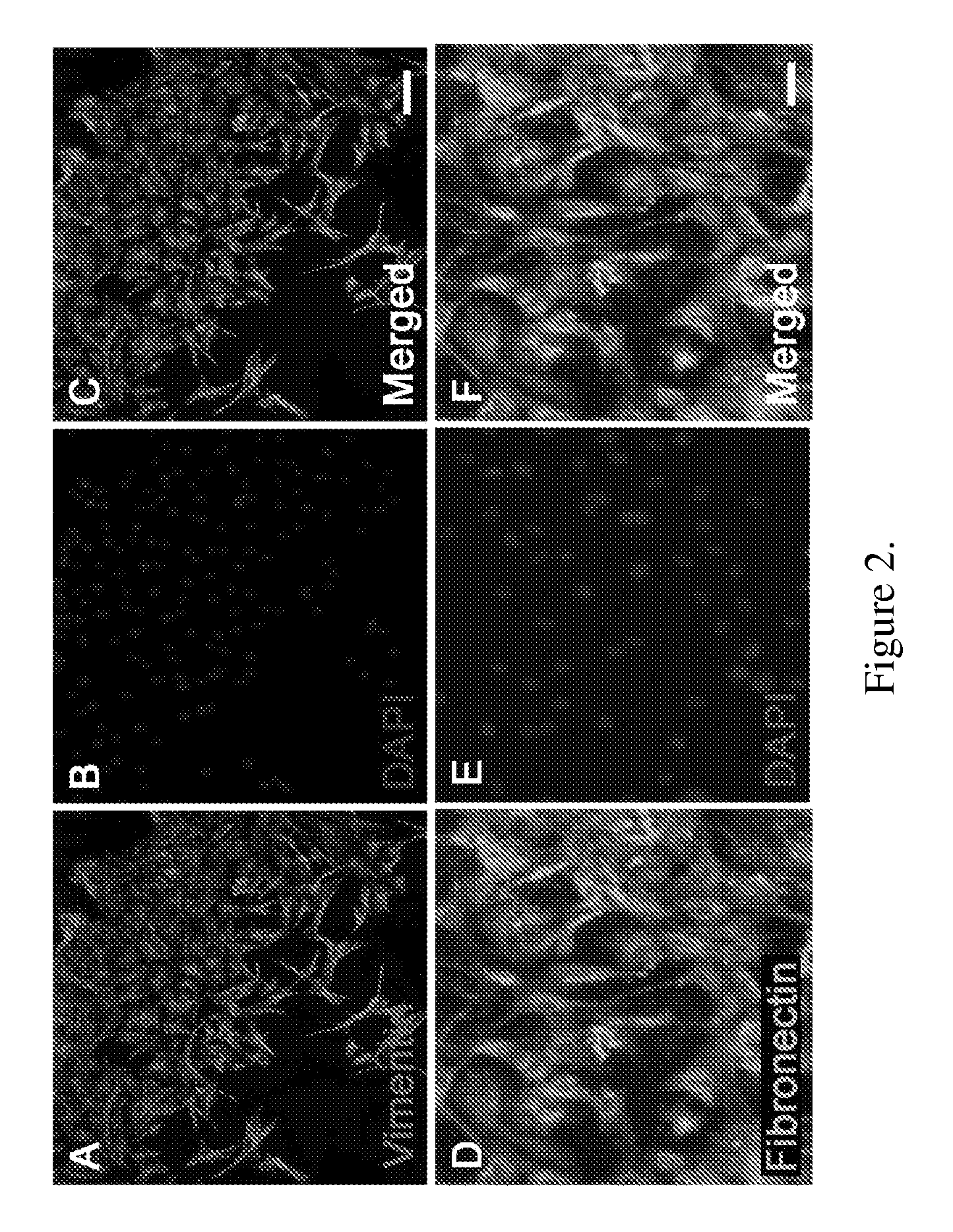 Amnion-derived stem cells and uses thereof