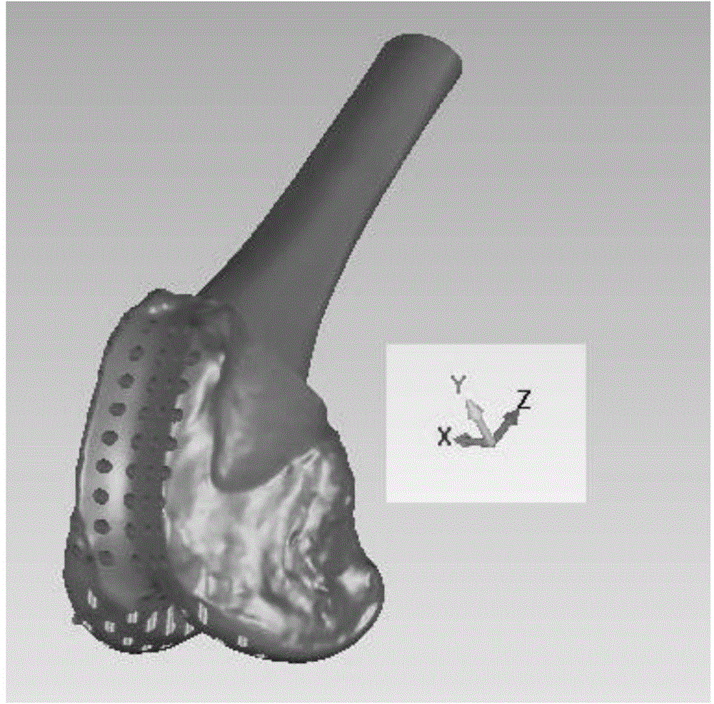 Anatomical composite three-dimensional scaffold tissue engineering cartilage and preparation method thereof