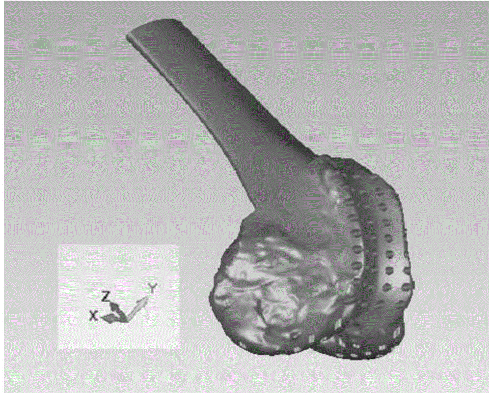 Anatomical composite three-dimensional scaffold tissue engineering cartilage and preparation method thereof