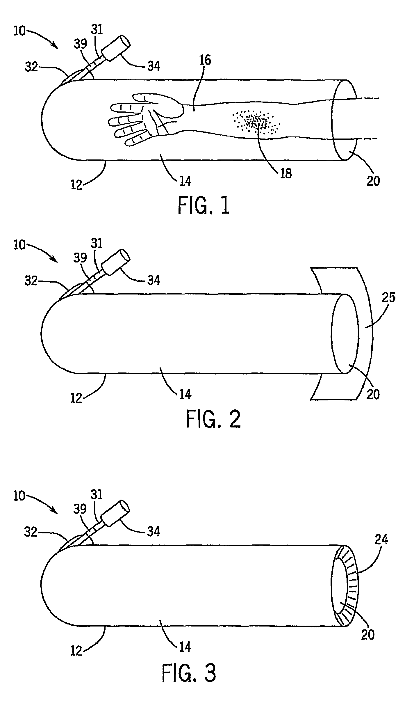 Wound chamber for limb