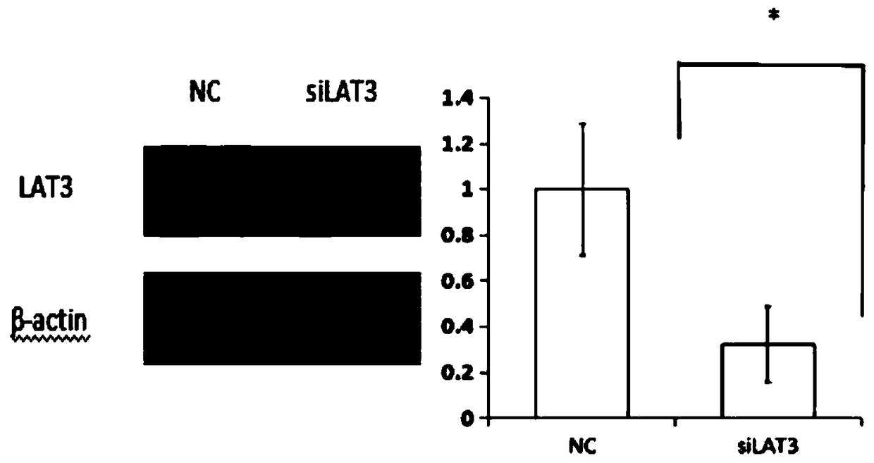 LAT3 protein expressed siRNA in specific in-vitro interference RA synovial cells and application of LAT3 protein expressed siRNA