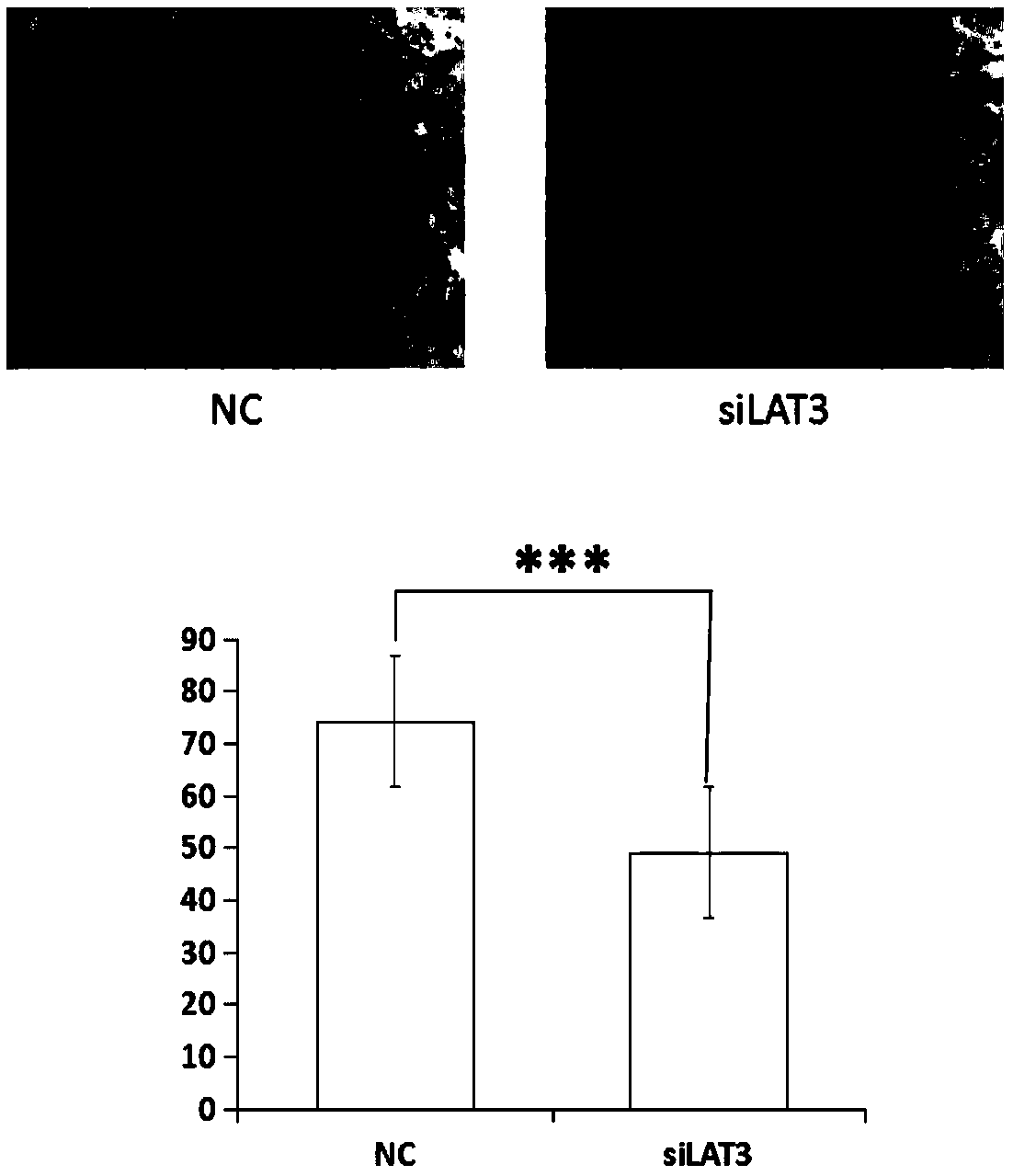 LAT3 protein expressed siRNA in specific in-vitro interference RA synovial cells and application of LAT3 protein expressed siRNA