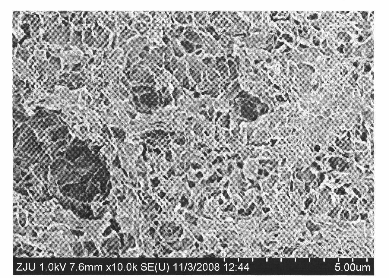 Heterogeneous layered mineralized coating on surface of medical implant and preparation method thereof