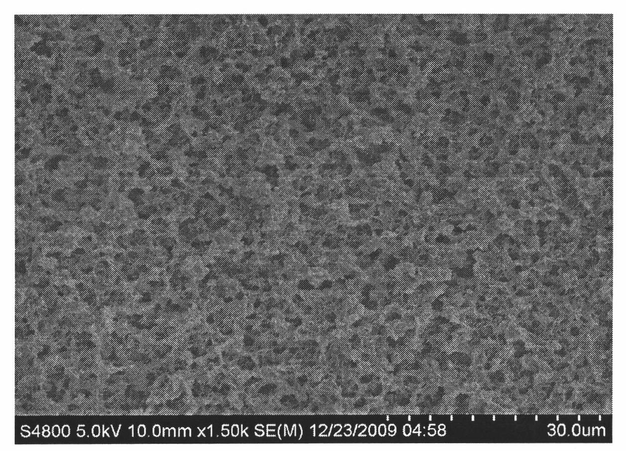 Heterogeneous layered mineralized coating on surface of medical implant and preparation method thereof