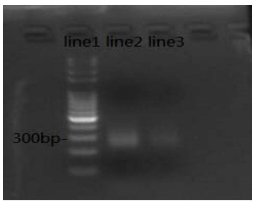 Probe library and kit for detecting lung cancer related 41 genes and application thereof