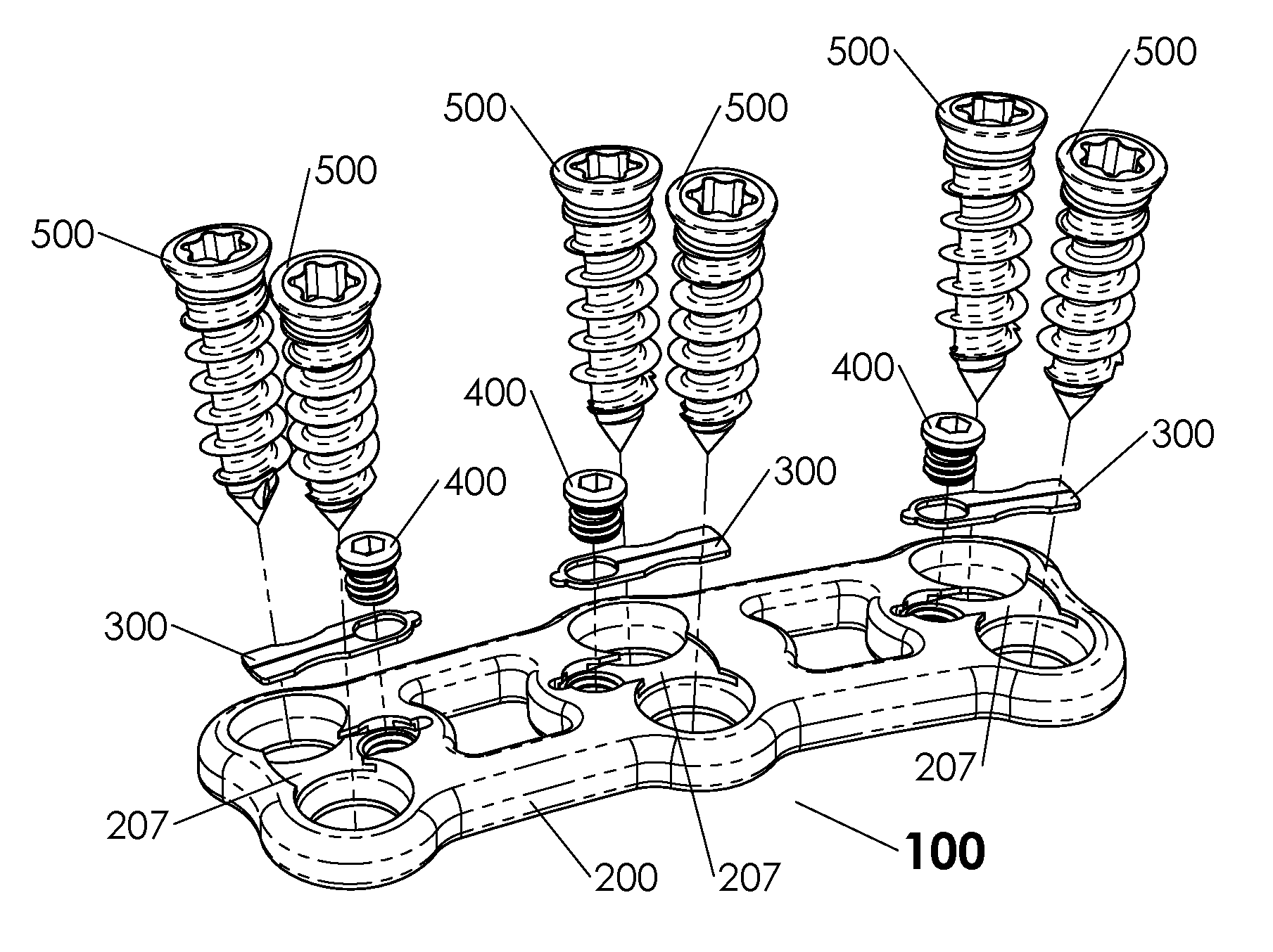 Expanding Blade Screw Retention System