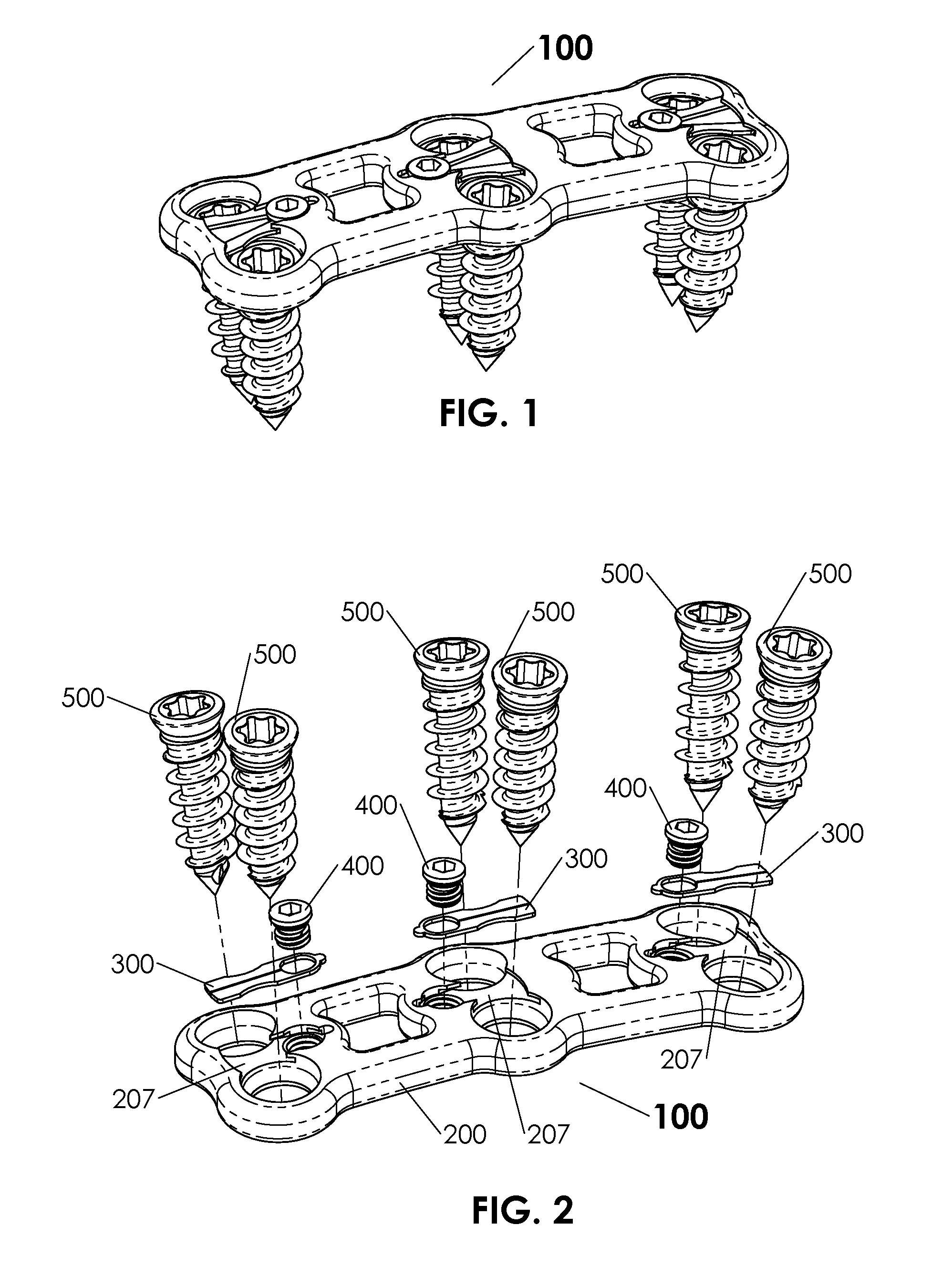 Expanding Blade Screw Retention System