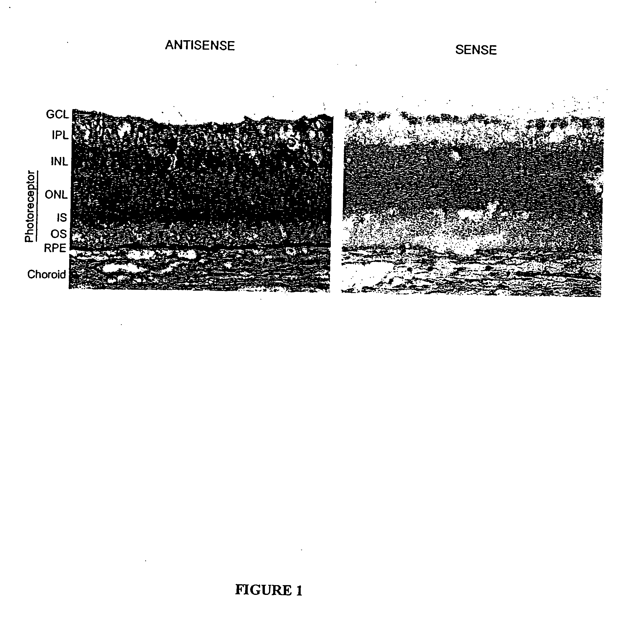 Pharmaceutical formulation comprising dinucleoside polyphosphates and salts thereof