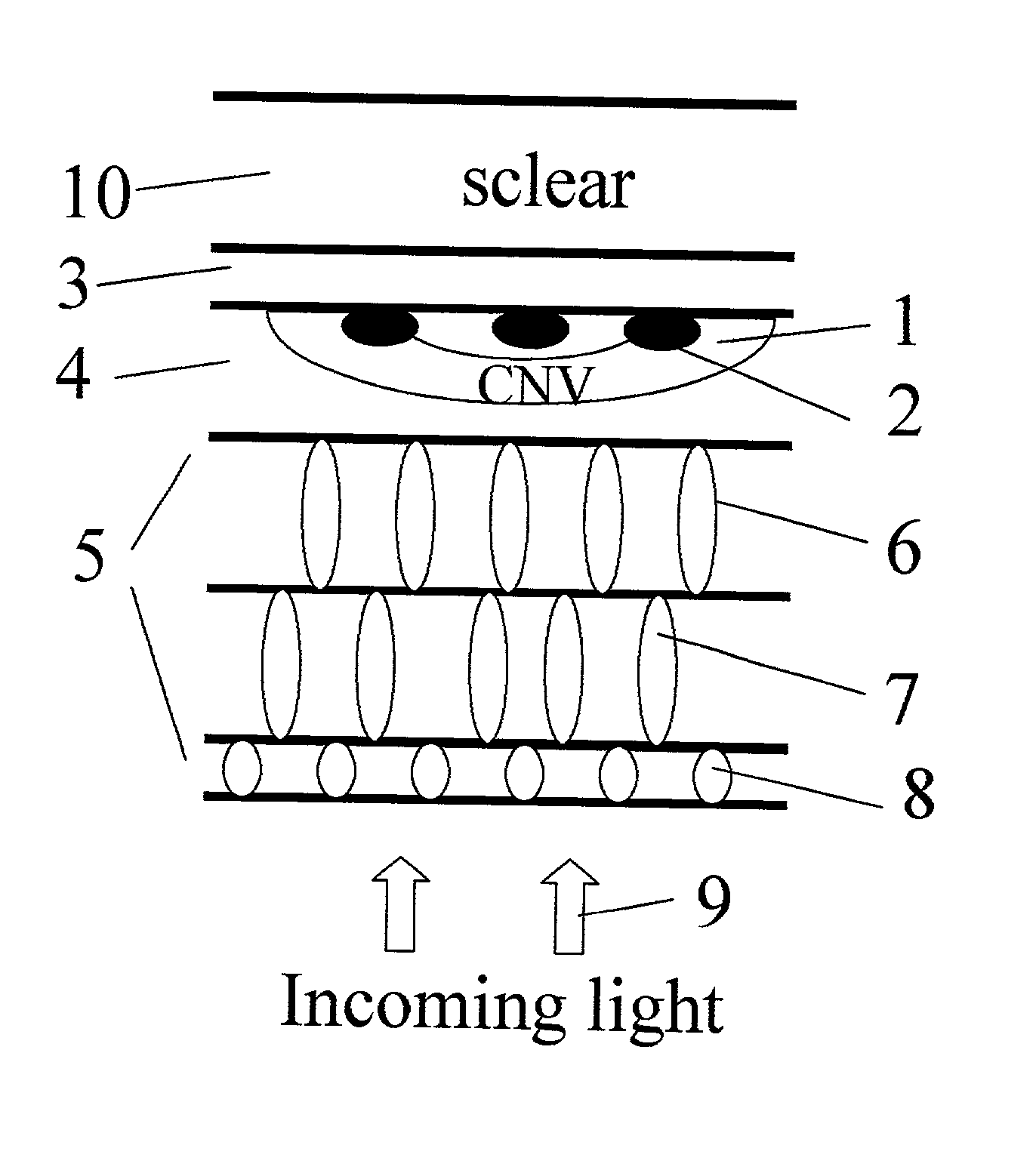 Apparatus and methods for prevention of age-related macular degeneration and other eye diseases