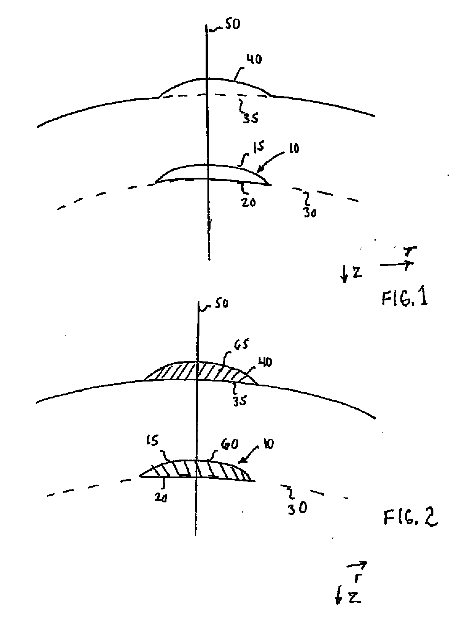 Design of Inlays With Intrinsic Diopter Power