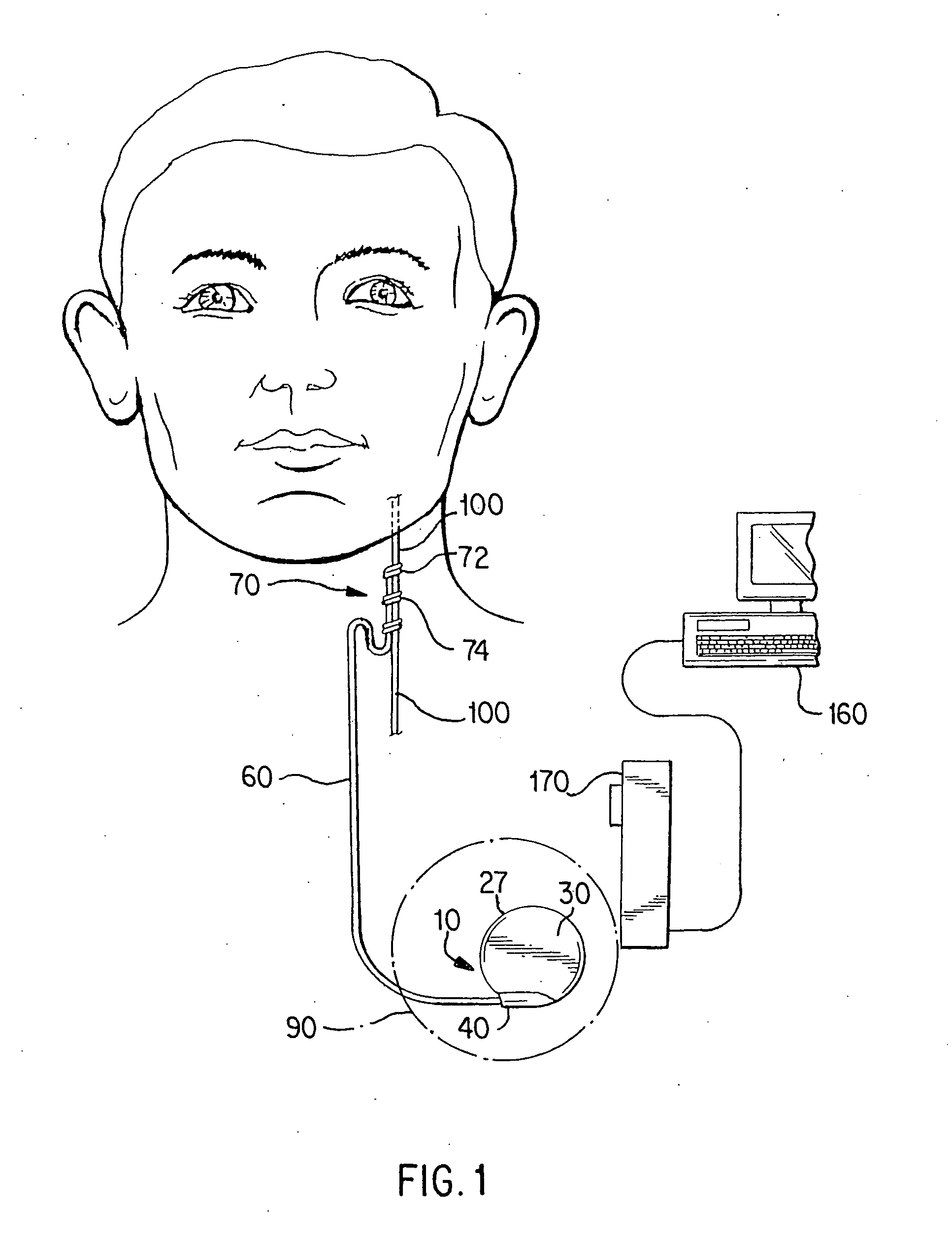 Cranial nerve stimulation to treat a hearing disorder