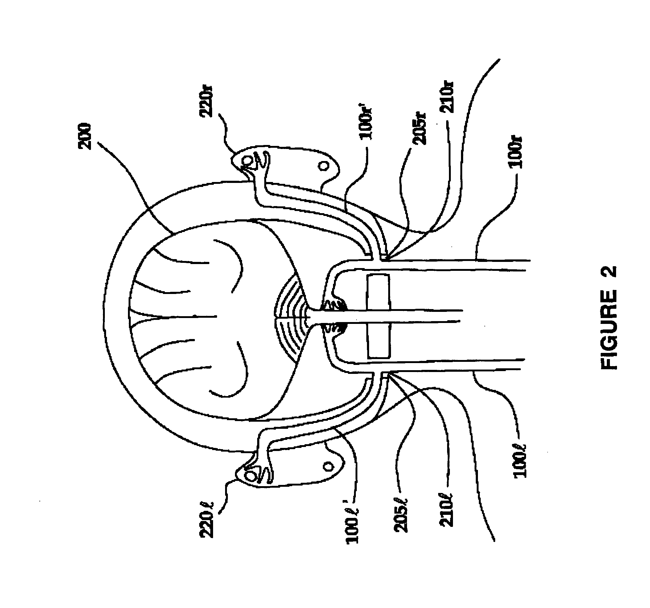 Cranial nerve stimulation to treat a hearing disorder