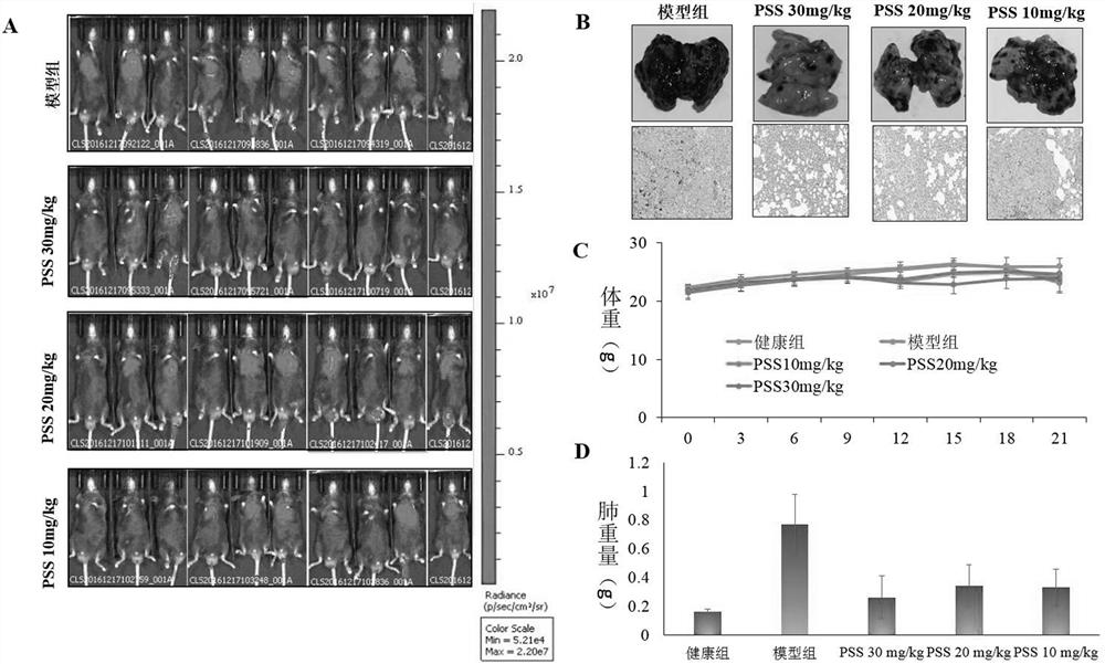 Application of sodium alginate diester in the preparation of drugs for preventing or treating tumor metastasis