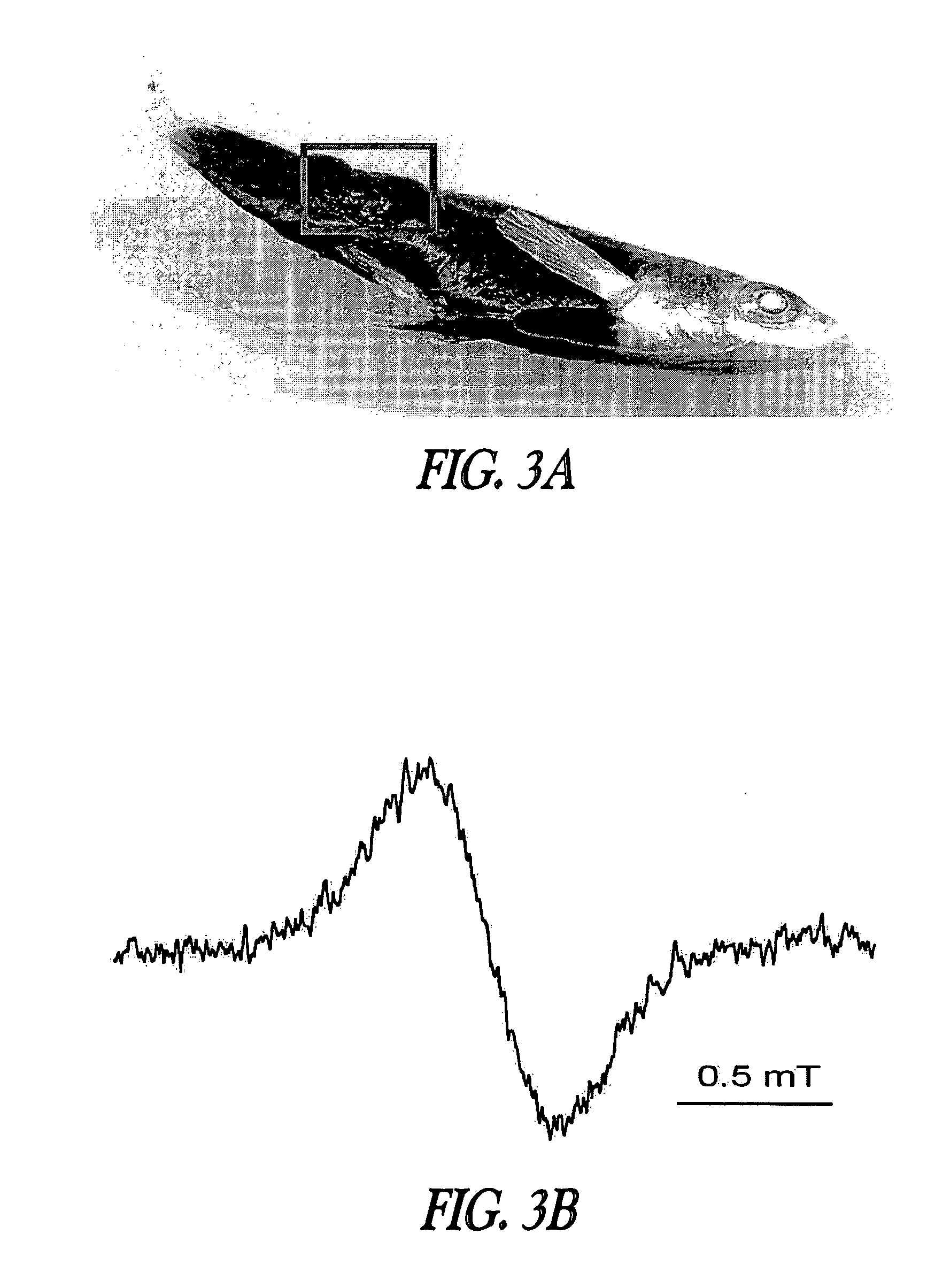 Dectecting melanoma by electron paramagnetic resonance