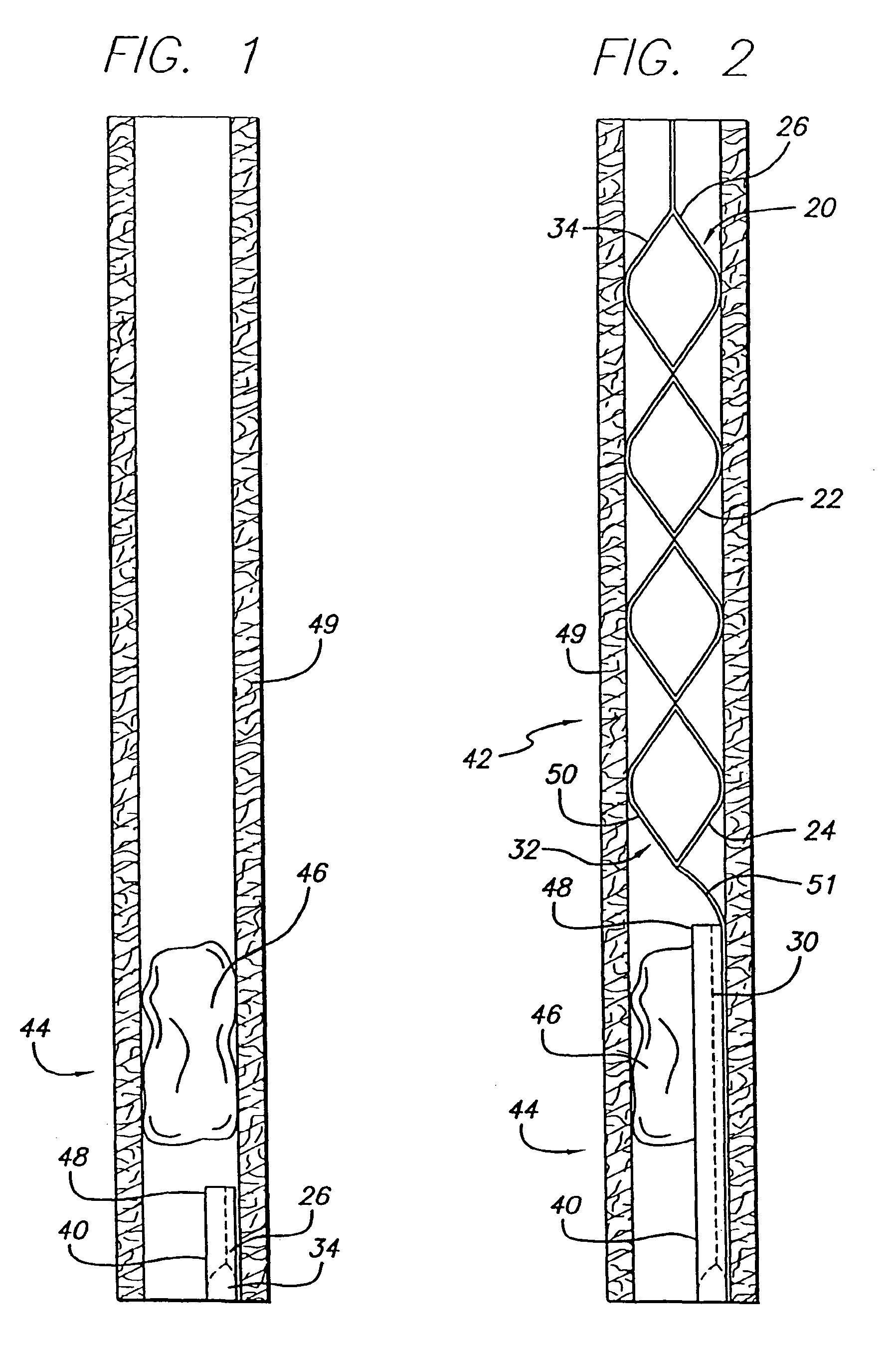 Snare