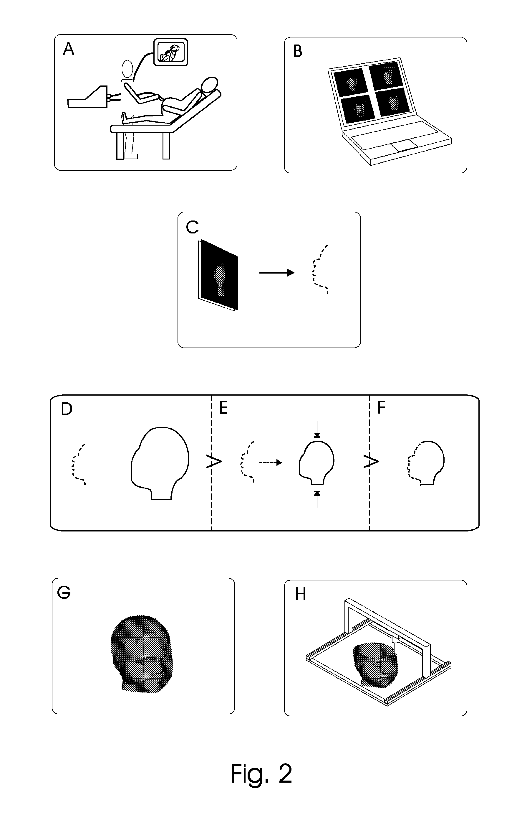 Method for the manufacturing of a reproduction of an encapsulated head of a foetus and objects obtained by the method