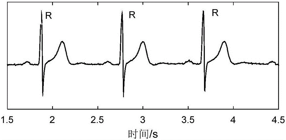 Electrocardiosignal fast identity identification method based on random tree