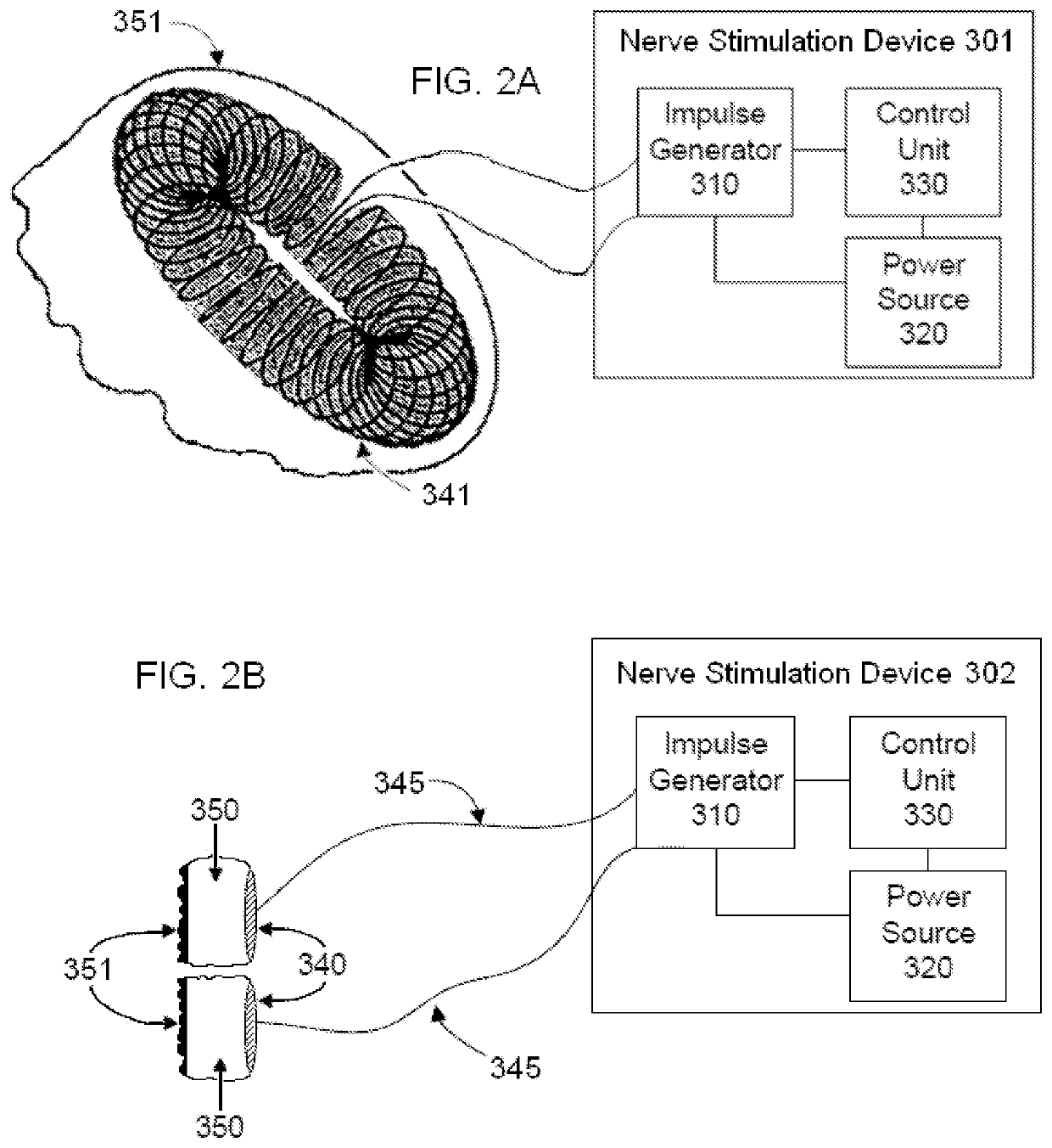 Vagal nerve stimulation to avert or treat stroke or transient ischemic attack