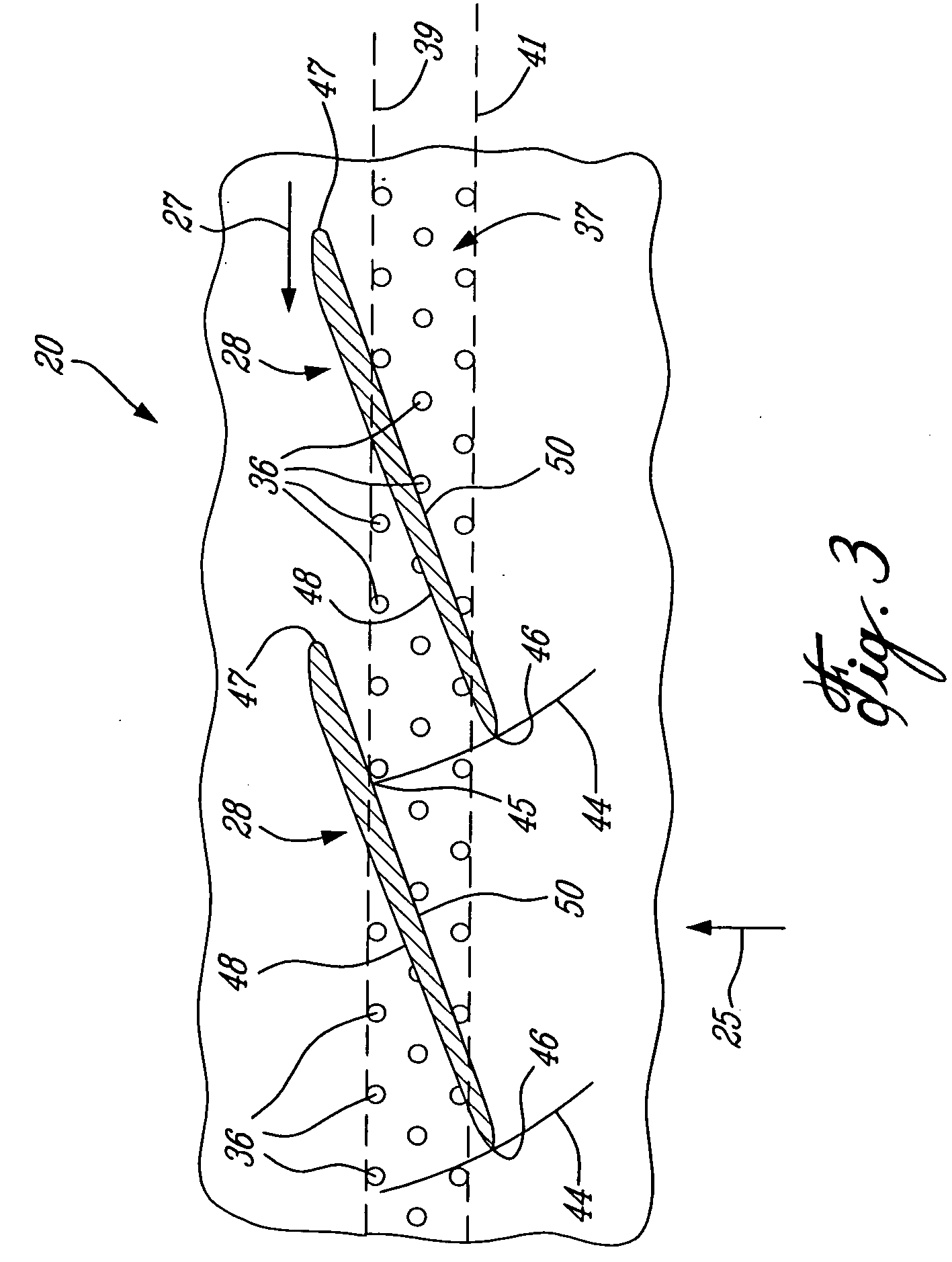 Shockwave-induced boundary layer bleed