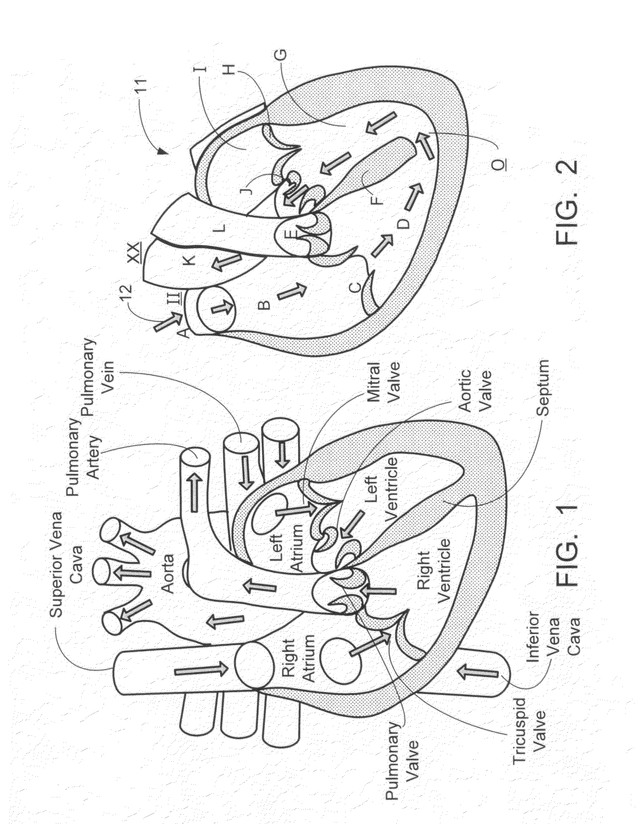 Inflatable exhibit of a human heart and method