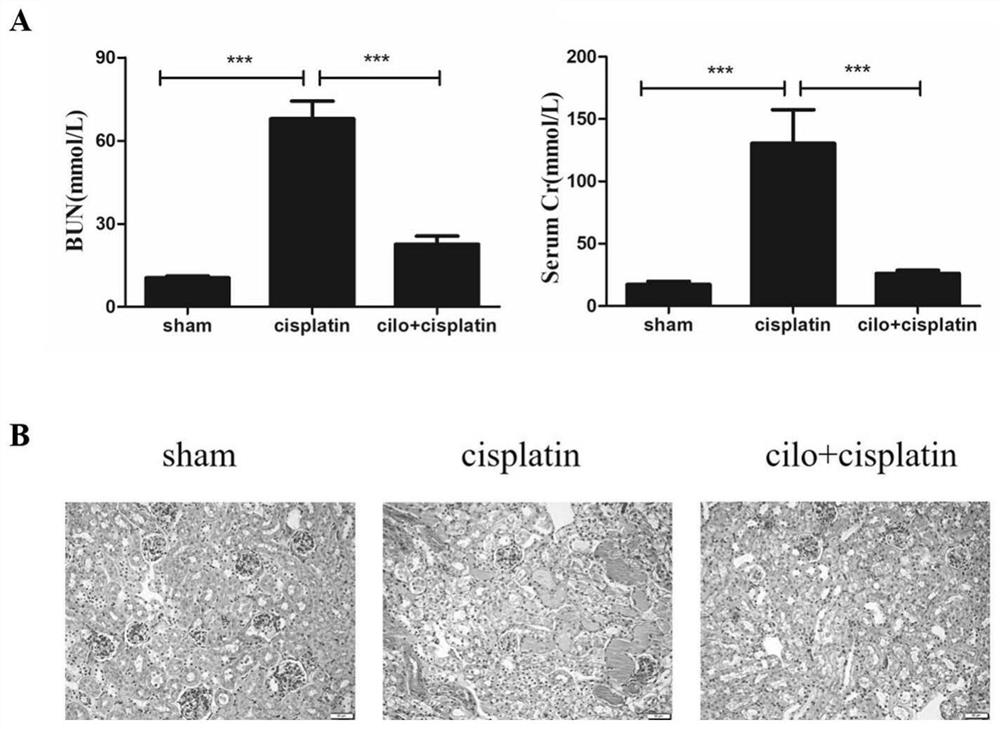 Use of cilomilast in the preparation of medicines for the treatment of acute kidney injury related diseases