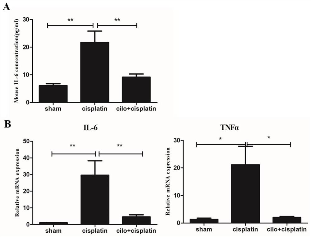 Use of cilomilast in the preparation of medicines for the treatment of acute kidney injury related diseases