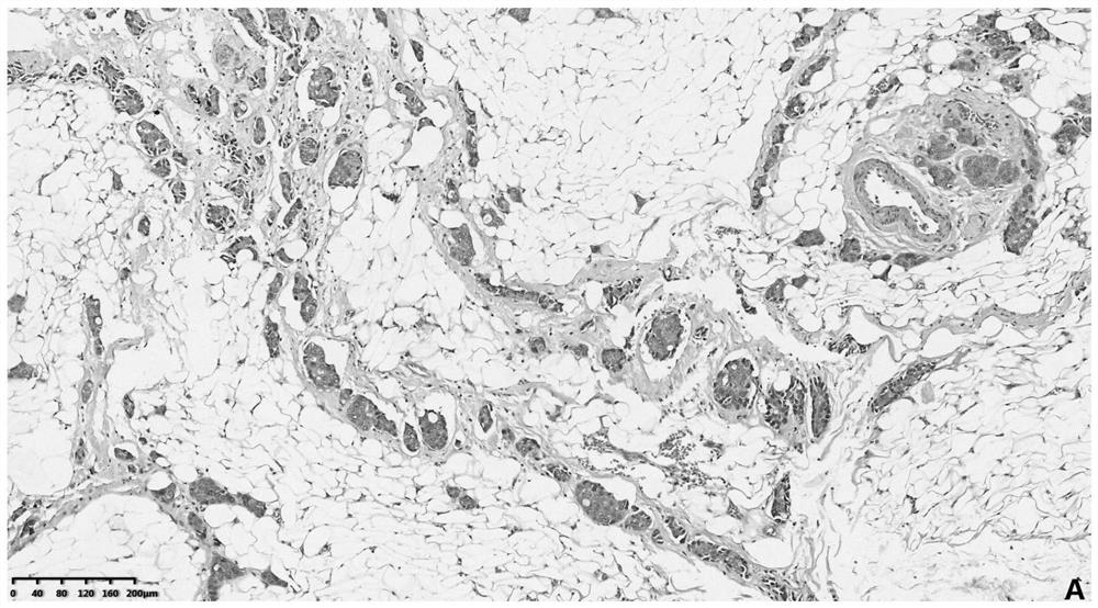 A kind of preparation method of lymph node tissue slice