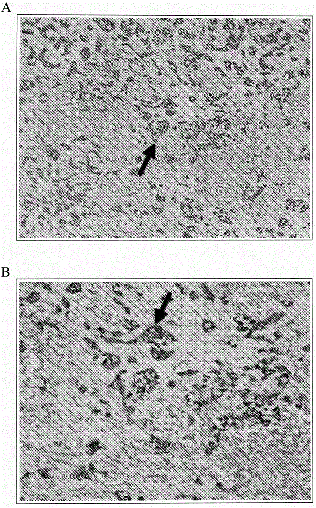 Direct immunohistochemistry assay