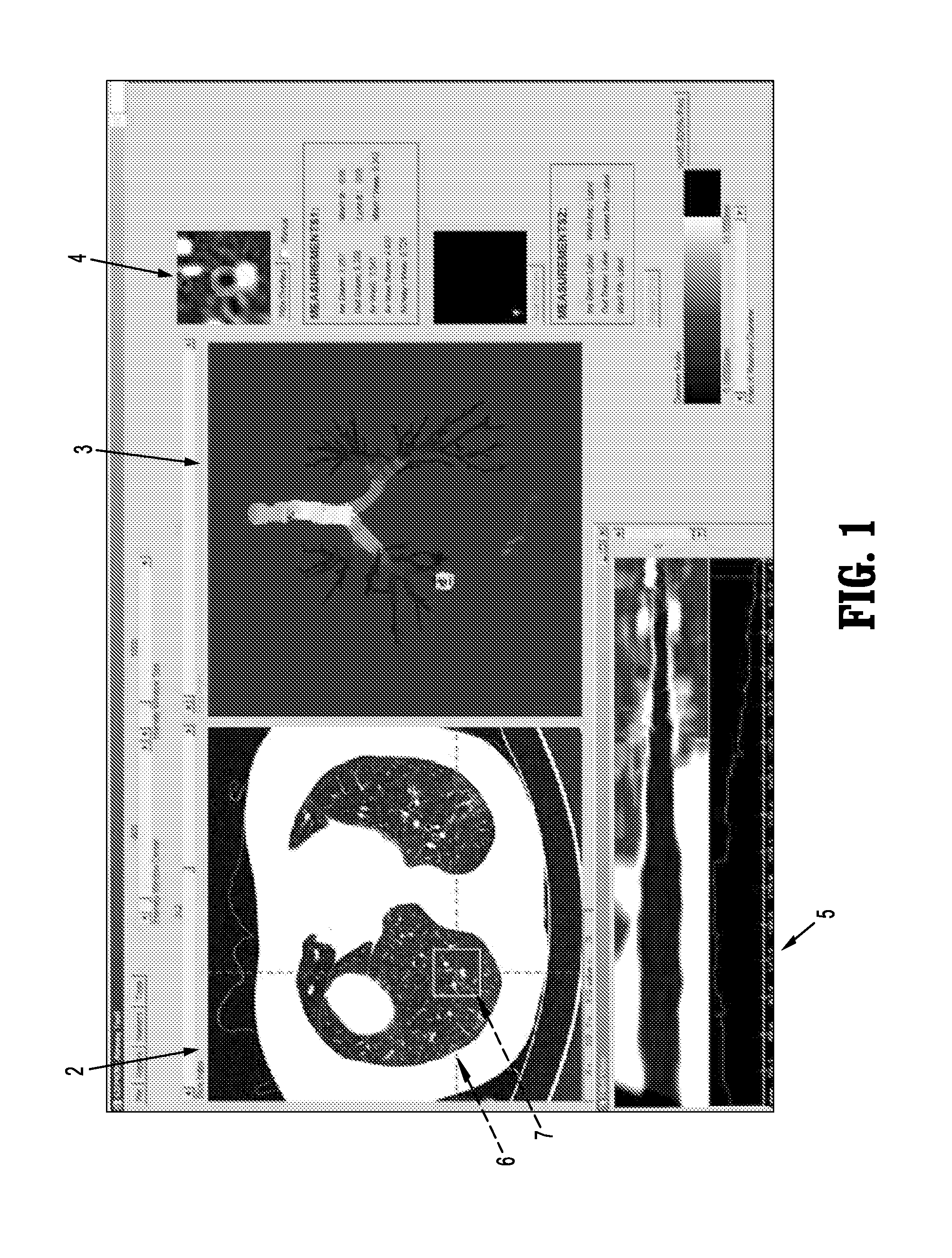 Dynamic graphical user interfaces for medical workstations