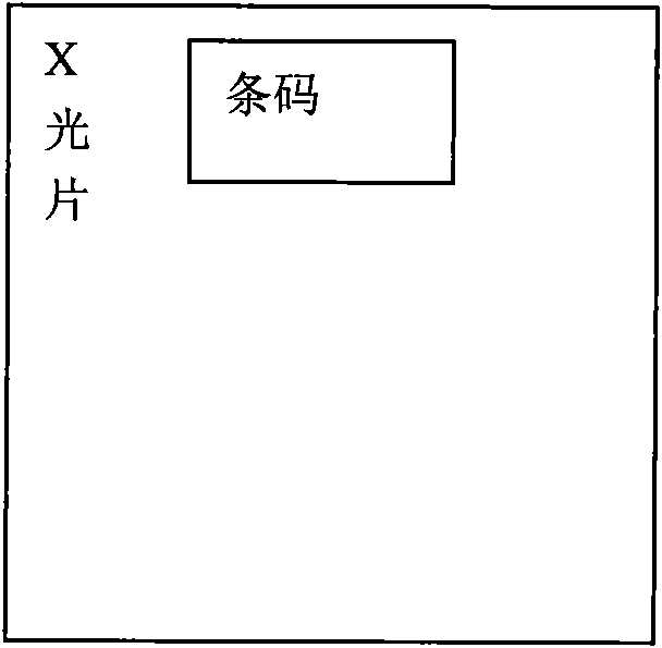 Method for manufacturing bar code on x-ray film