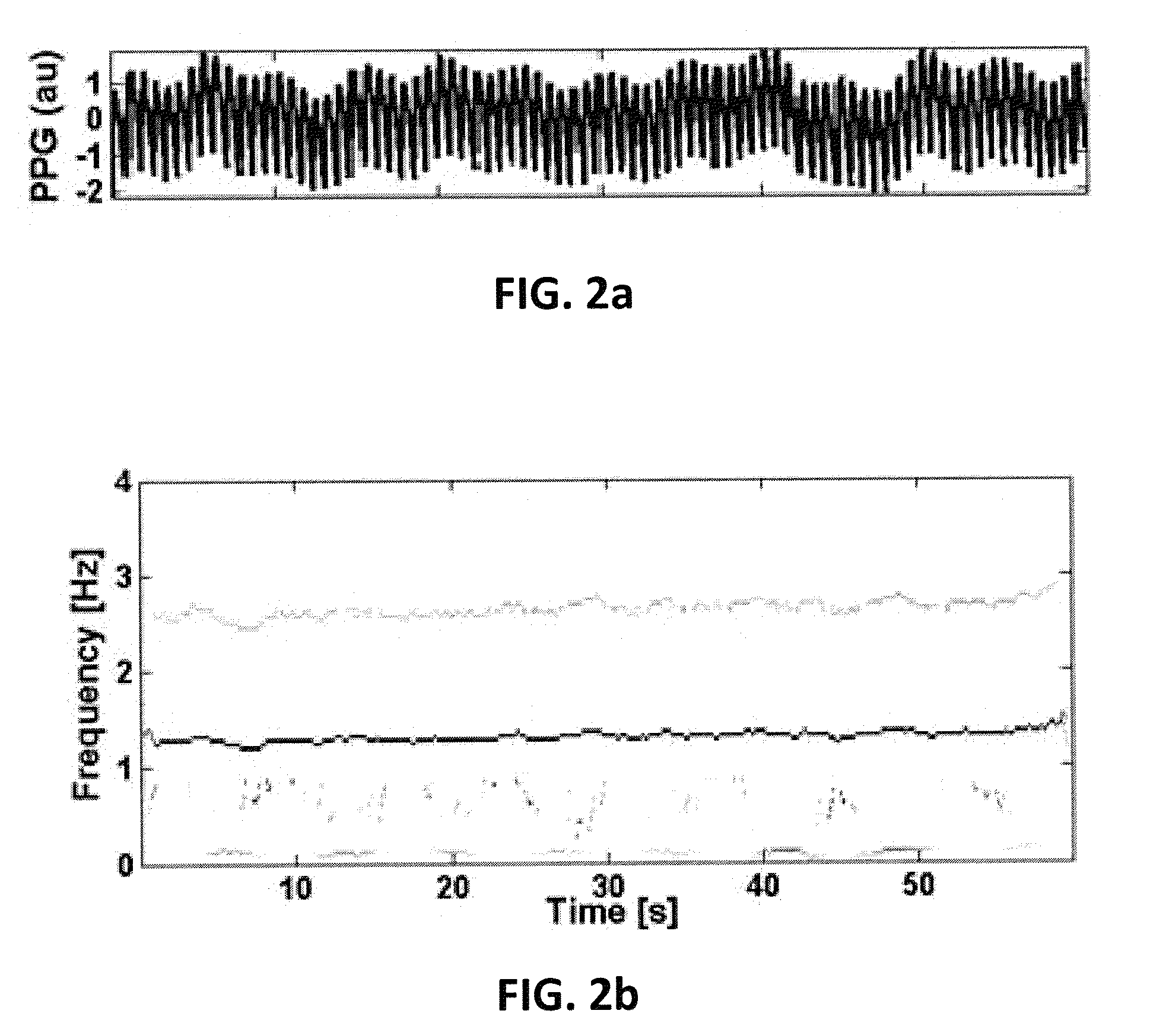 Apparatus and method for respiratory rate detection and early detection of blood loss volume