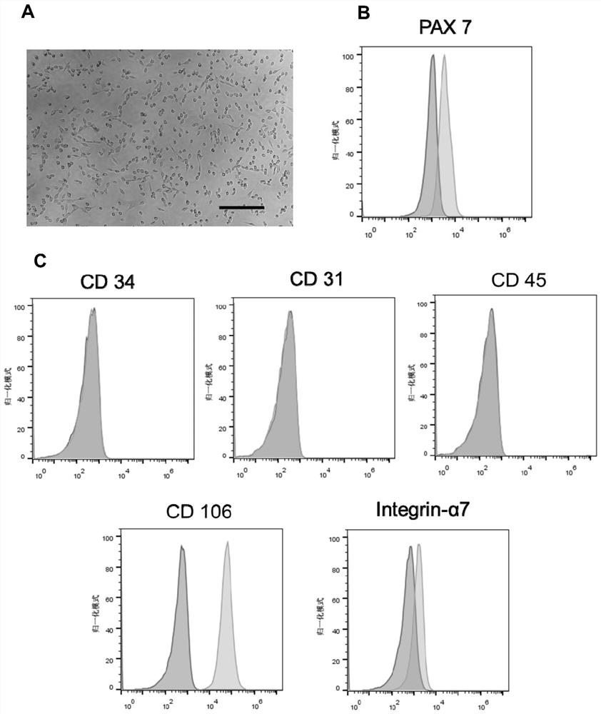 Stem cell medicine for treating diabetes