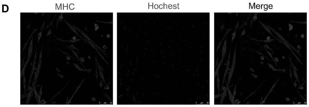 Stem cell medicine for treating diabetes