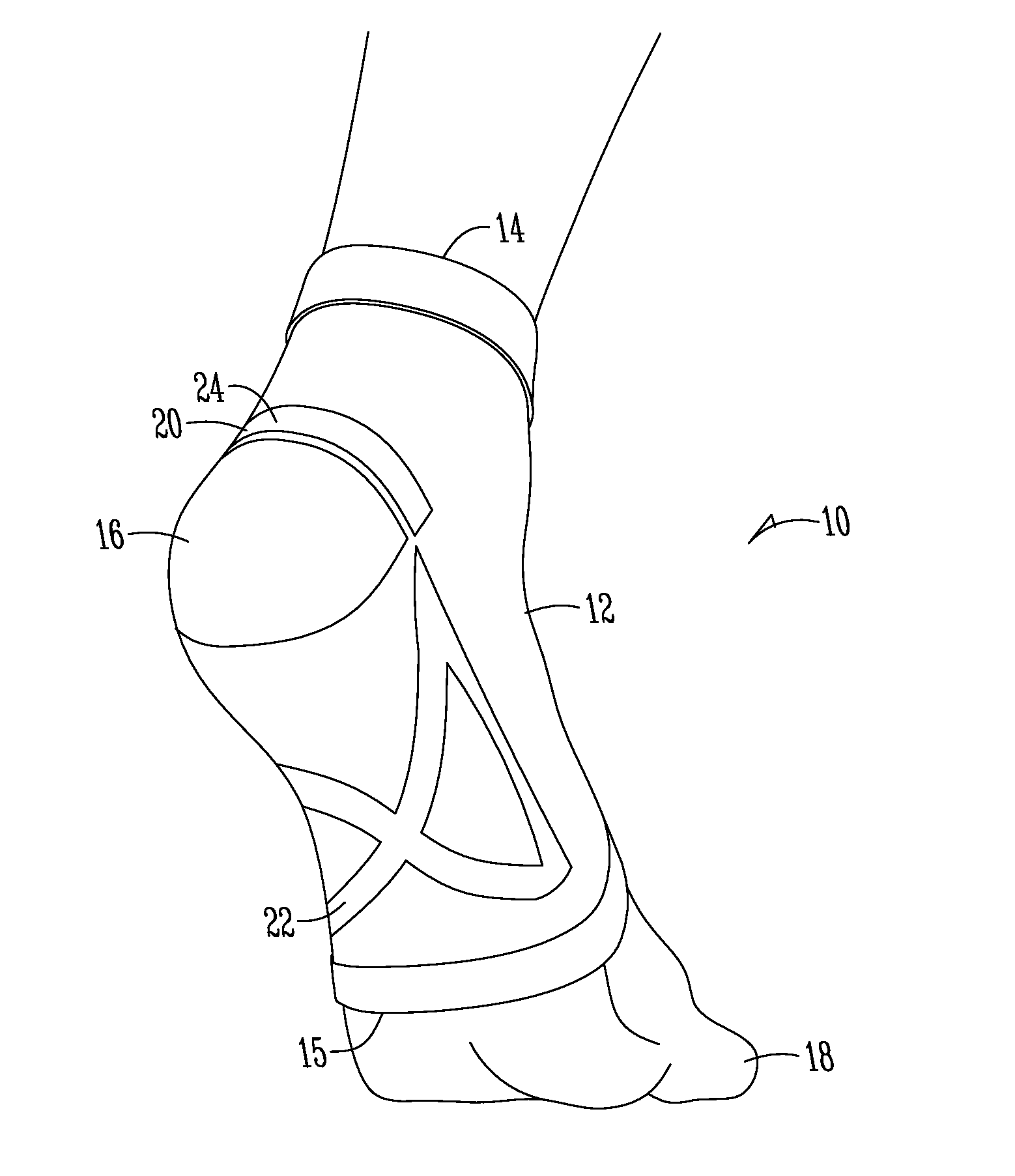 Plantar fasciitis sleeve having targeted compression